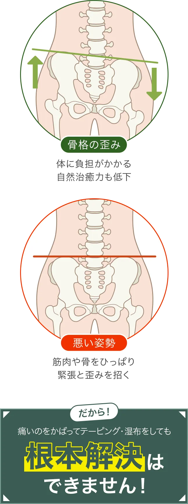 痛みやシビレなどの不調の原因